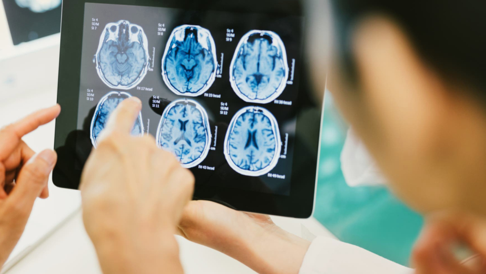 Motor and verbal compulsions such as constant twitching or clearing can be quite stressful for those affected. Tourette's syndrome is a severe variation. The tic disorder's underlying brain network has now been located.