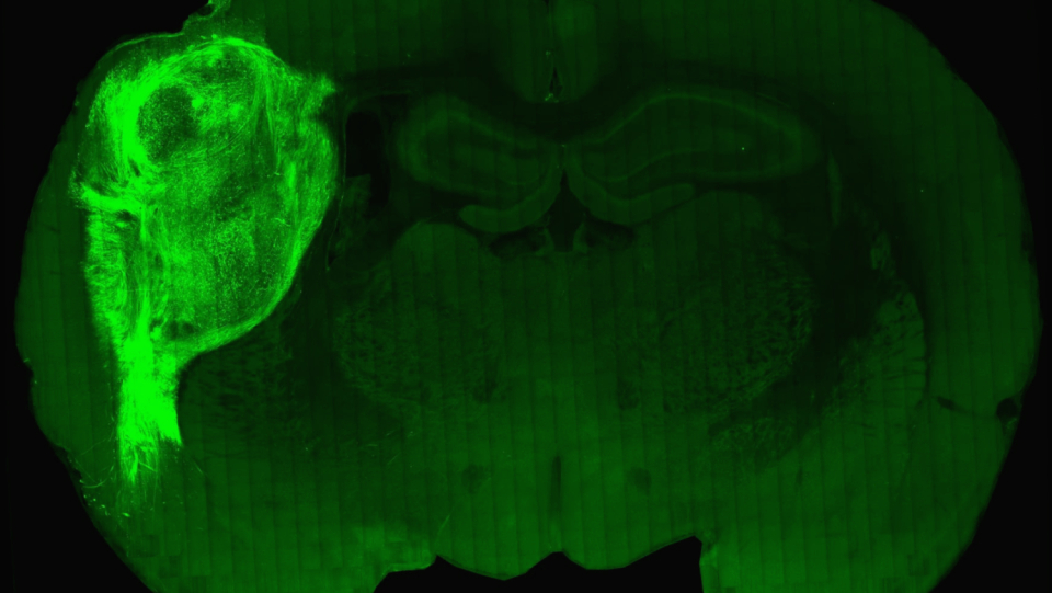 In order to find therapies for neurological diseases, researchers have created a hybrid brain: They used rats with human brain organoids. Is this ethical?