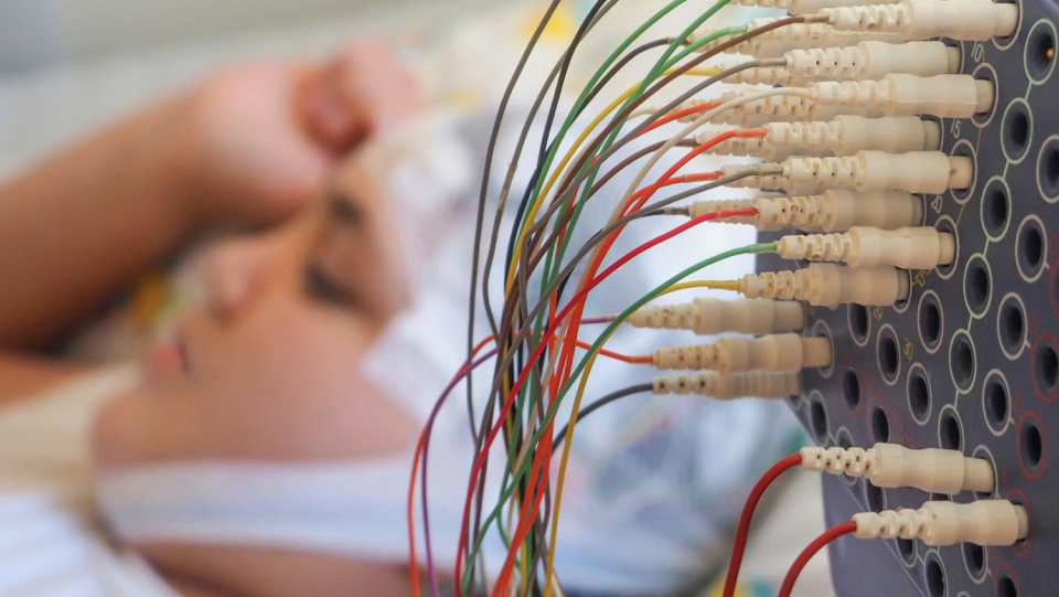 If a patient with a brain injury no longer reacts to speech, the forecast is bad.
 But some of those affected still show a reaction in the EEG: a good sign.