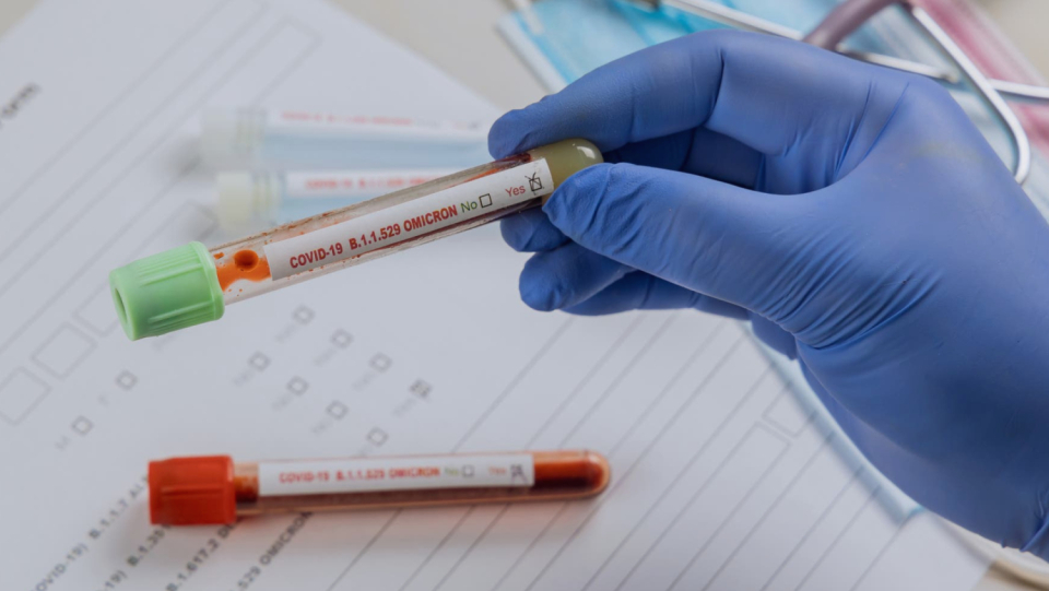 Omikron corona virus infection is significantly easier than with older forms when sucked and recovered.
However different immune cells respond to omicron and presumably shield the majority of people from a challenging path.