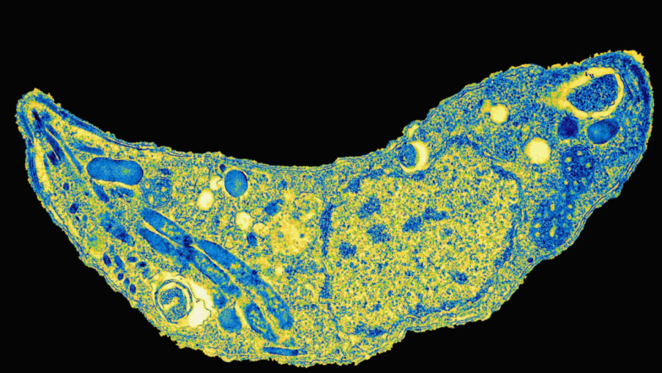 Infection with toxoplasma is generally thought to be harmless.
But some contend that the brain is affected by the unicellular organ, making it more susceptible to neuropsychiatric disorders.